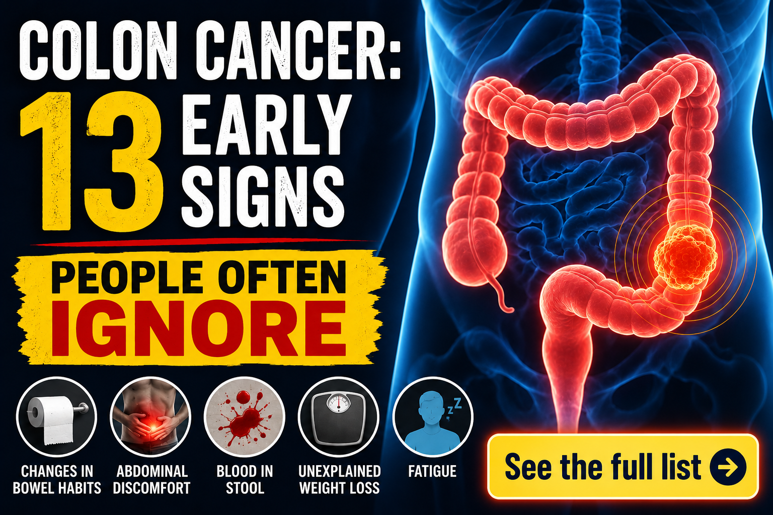13 Warning Signs Of Colon Cancer People Ignore